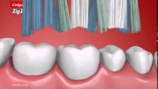 Colgate Zigzag Supermarket Tvc