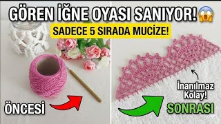 Gören İğne Oyası Sanıyor Sadece 5 Sırada Biten Tek Renk Mucize