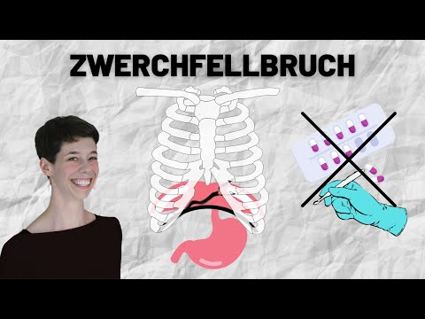 Video: Würde ein Hiatushernie Kurzatmigkeit verursachen?