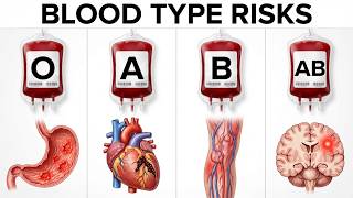 Your Blood Type is Deciding How You Die (The Science)