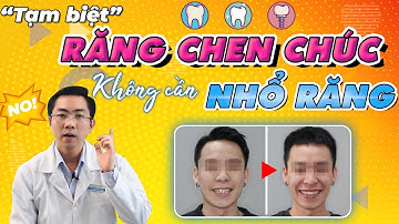 Niềng Răng Chen Chúc - Hẹp Hàm Không Cần Nhổ Răng