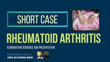 Rheumatoid Arthritis ( Short Case )