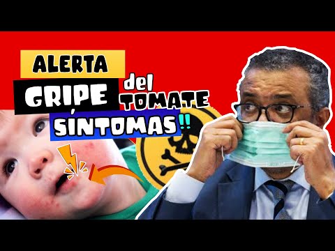 ALERTA  ⚠️ CIENTÍFICOS REVELAN SÍNTOMAS DE "GRIPE DEL TOMATE" ????????