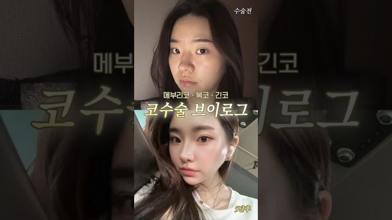 등록한썸네일