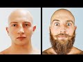 Beard Growth Transformation | 1 Year Time Lapse