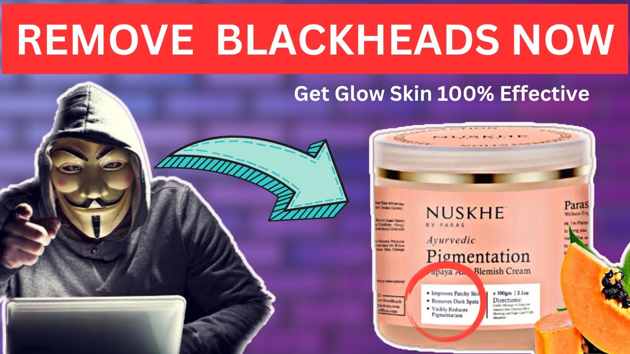 Best Facecream 😍 for Blackhead Removal on Face Nuskhe By Paras