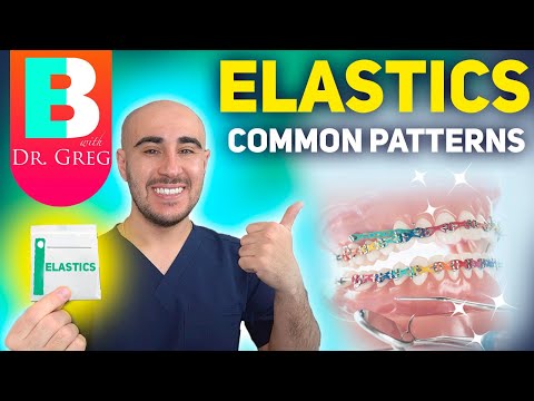 BRACES ELASTICS! Most Common Patterns for Braces