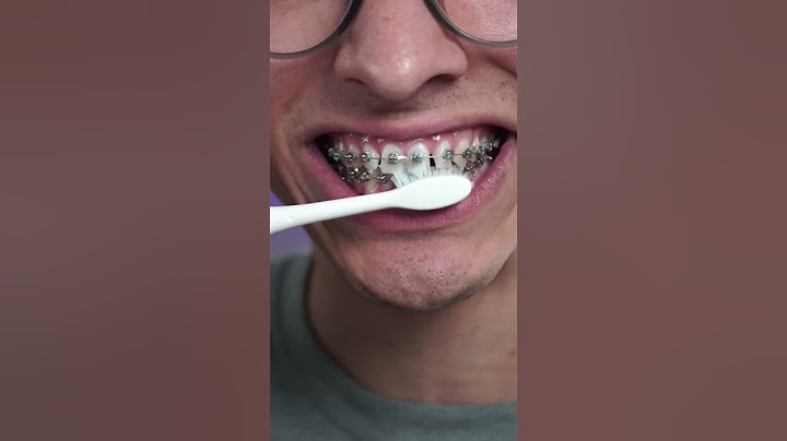 Braces Journey: Manual Vs Electric Toothbrush