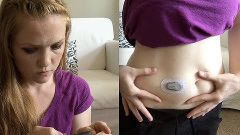Dexcom G6 Update - Inserting a New Sensor + 10-Day Review!