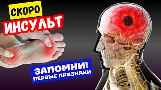 8 Признаков скорого ИНСУЛЬТА! Тело предупреждает, НЕ Пропусти - ВЫЖИВЕШЬ