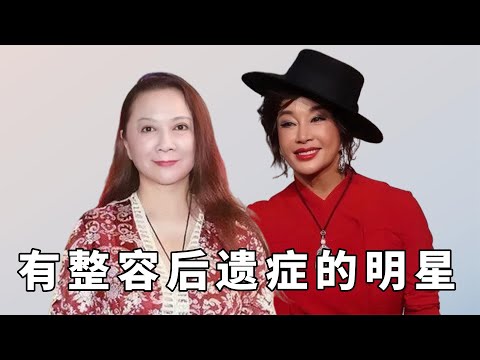 有整容后遗症的明星，舒畅面瘫、蔡明认不出，可惜世上没有后悔药