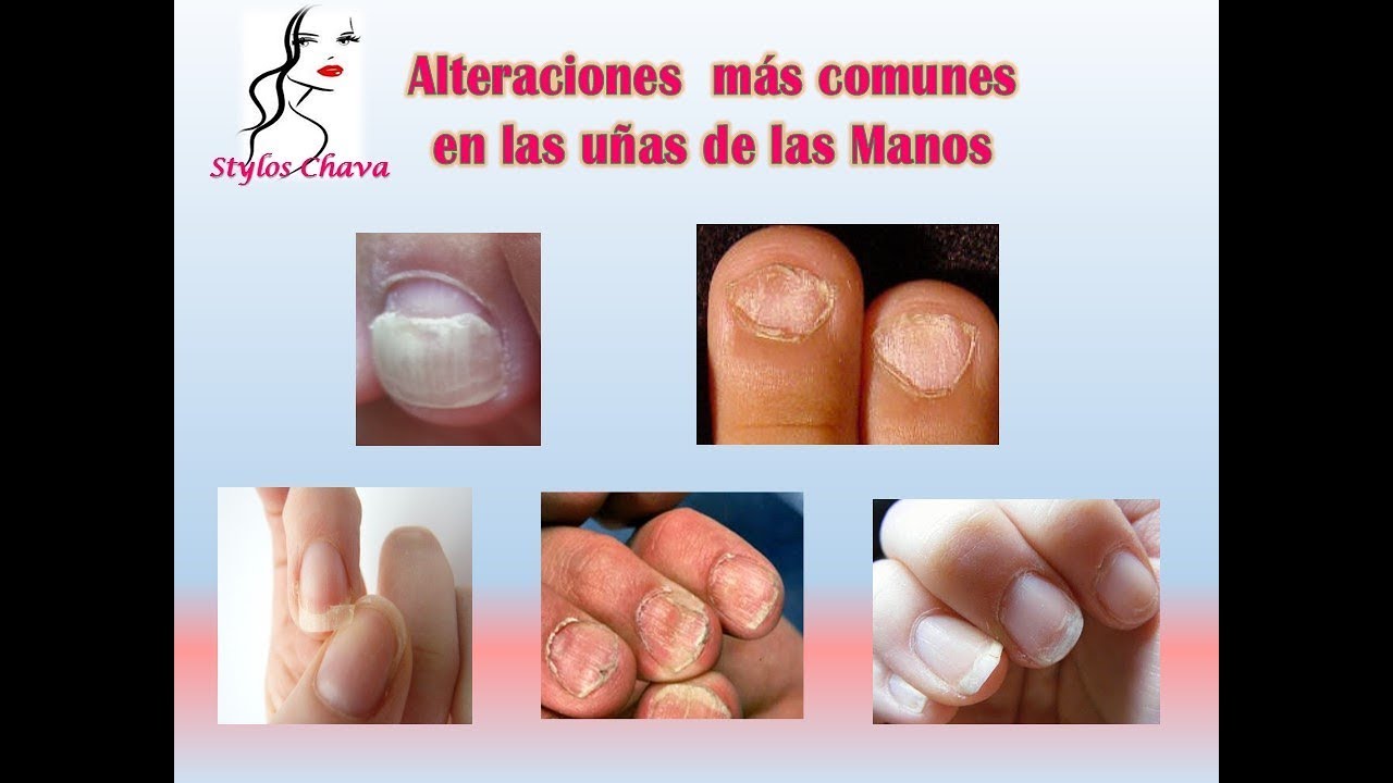 Como limpiar las uñas por dentro