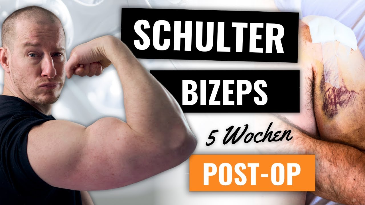 ARM WIRD DICKER! 5 Wochen nach SLAP-OP endlich Fortschritte!