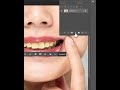 How To EASILY Whiten Teeth In Photoshop #shorts #photoshopshorts