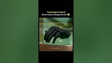Future Is Now: This Bionic Hand Can Work Even After Detachment!"#BionicHand #tech #shorts