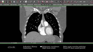 [CT] CTA for Pulmonary Embolism | Search Pattern
