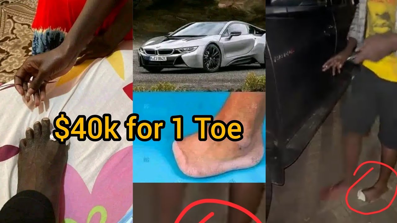 People sell thier toés in Zimbabwe for 40,000 YouTube