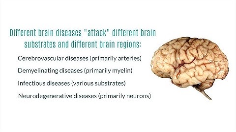 Neurodegenerative Diseases of the Brain