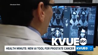 New AI tool could help detect prostate cancer