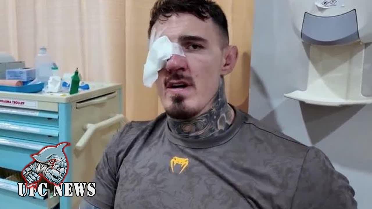 Том Эспинелл поделился кадрами травмы глаза, а врач опубликовал обновленную информацию — UFC News