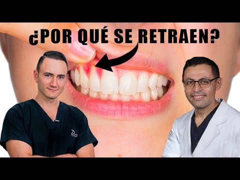 Vídeo: Tratamiento De Las Encías En Retroceso: Lo Que Debe Saber