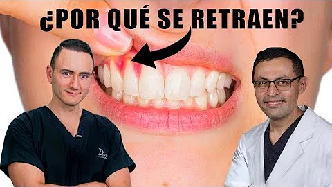 ¿Por qué se retraen mis encías?