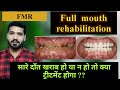 सारे दाँत खराब है तो कैसे ठीक होंगे ? Full mouth rehabilitation | FMR | full mouth reconstruction