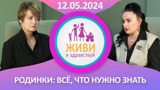 Живи и здравствуй. Родинки: все, что нужно знать (12.05.2024)