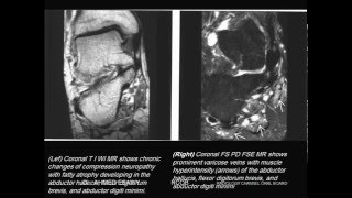 29-Radiology Channel Imaging Oral Board Mri Ankle Foot