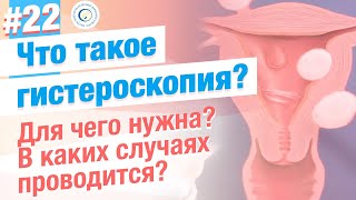 Что такое гистероскопия? Чем хороша гистероскопия?