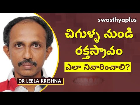 మీ చిగుళ్ళ నుండి రక్తం వస్తోందా? | Bleeding Gums in Telugu | Dr Leela Krishna
