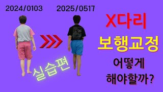 엑스다리 패턴의 체형/보행교정. 실습편.