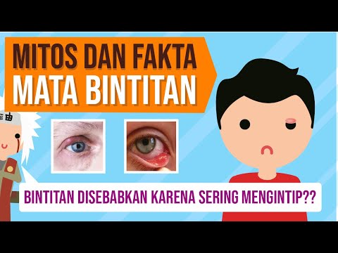 Mitos dan Fakta Mata Bintitan