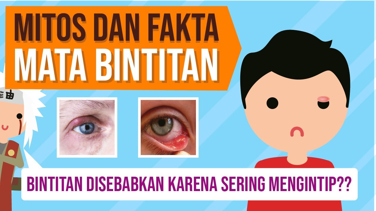Mitos dan Fakta Mata Bintitan