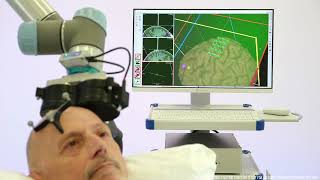 Robotized TMS with TMS-Cobot and LOCALITE TMS Navigator