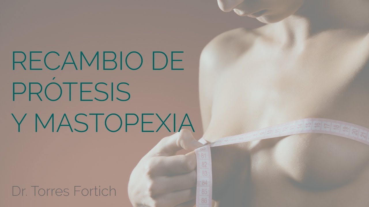 Recambio de prótesis y mastopexia - Dr Torres Fortich - Vigo - YouTube