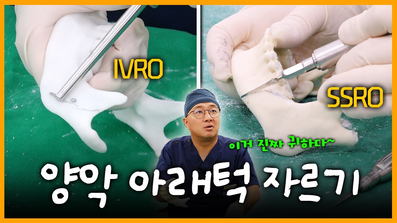 양악수술, 아래턱을 잘라보겠습니다! IVRO, SSRO 한 번에 보기!!ㅣ양악수술 시연 하편 하악자르기ㅣ