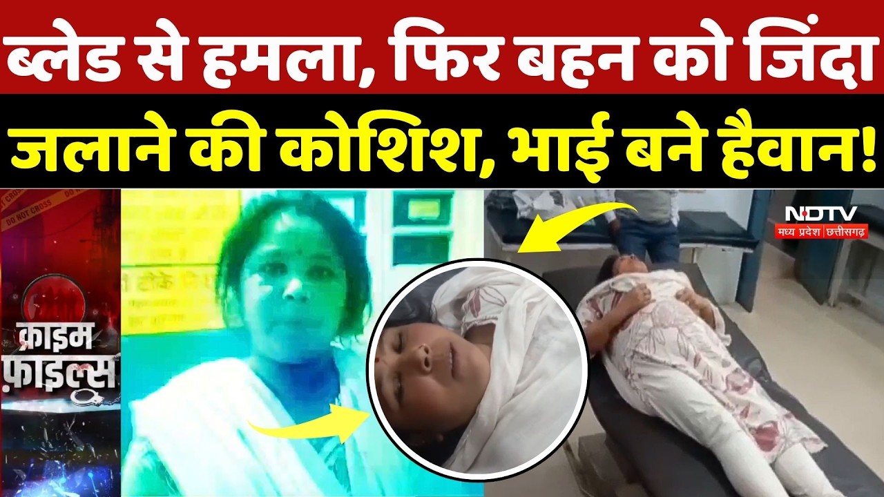 Satna Crime News: Blade से हमला, फिर बहन को जिंदा जलाने की कोशिश, Property के लिए भाई बन गए हैवान!