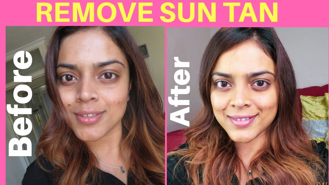 How to remove Sun Tan quickly Immediate Results Home Remedy YouTube