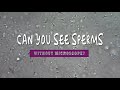 Can You See Sperm Without A Microscope - With Just Your Eyes