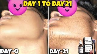 Day 21 Beard Growth Result 😳 | Man Matters Kit Really Working? | man matters beard oil review |