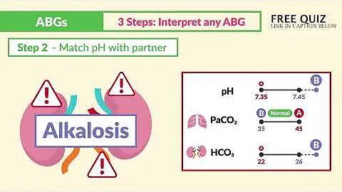 ABG - Arterial blood gas interpretation made simple in 8 minutes RN, LPN, LVN for NCLEX