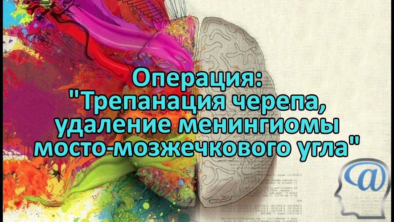 ⁣Операция. Трепанация черепа, удаление менингиомы мостомозжечкового угла