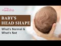 Baby&#39;s Head Shape - What&#39;s Normal and What&#39;s Not?