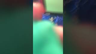 Making Fun Of Suprise Egg