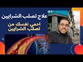 علاج تصلب الشرايين وامراض القلب بدون أدوية كلام مهم جدا 