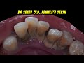 KARANG GIGI | Dentist | Dokter Gigi Tri Putra