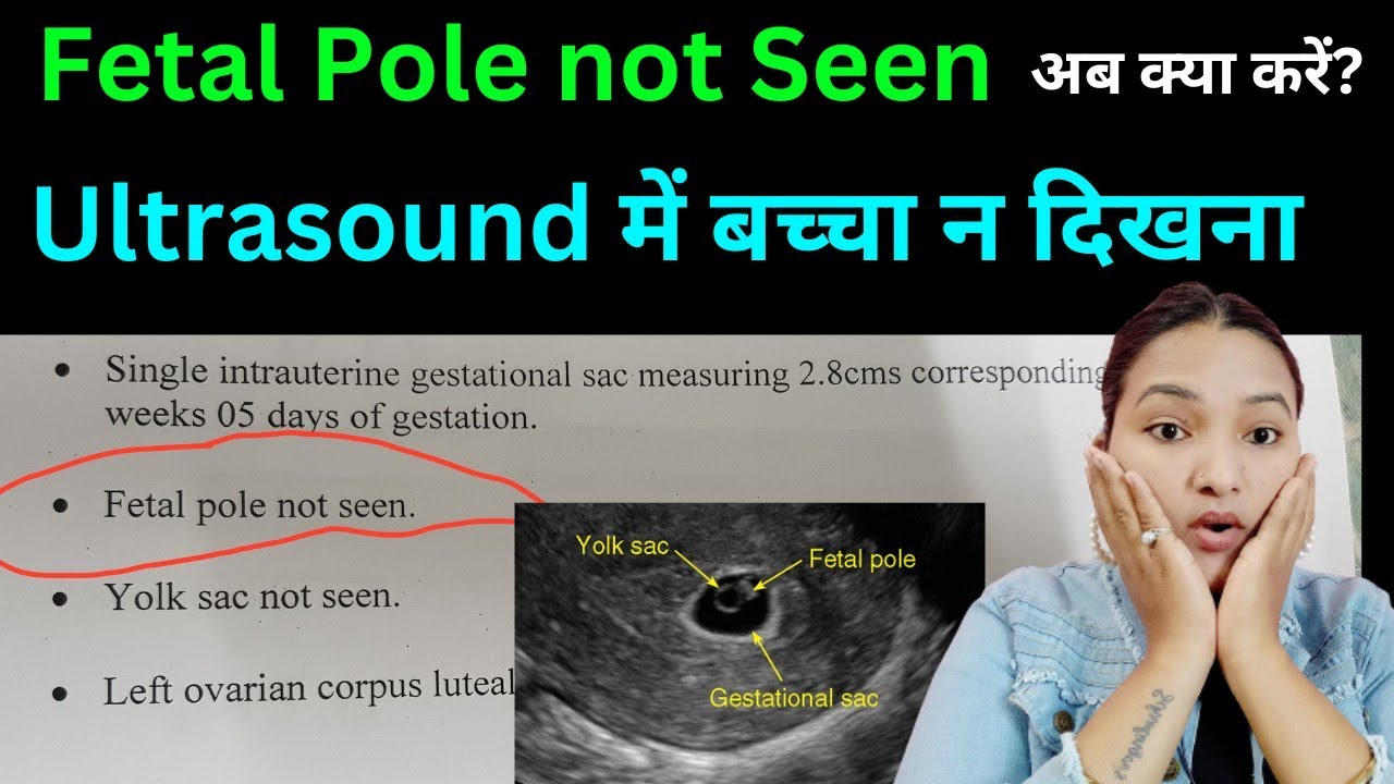 fetal presentation meaning in hindi