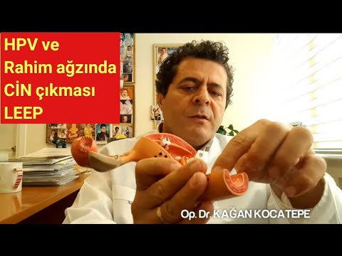 Rahim ağzı kanseri öncüleri CIN 1,2,3 (LGSIL-HGSIL), ASCUS, Tip 16-18 HPV,kolposkopi,LEEP konizasyon