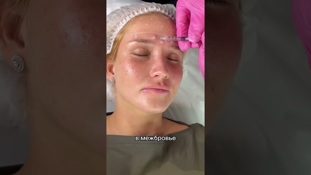 Самый популярный и действенный укол красоты - ботокс 💉 INST: kuuerbaeva.g baeva #косметолог